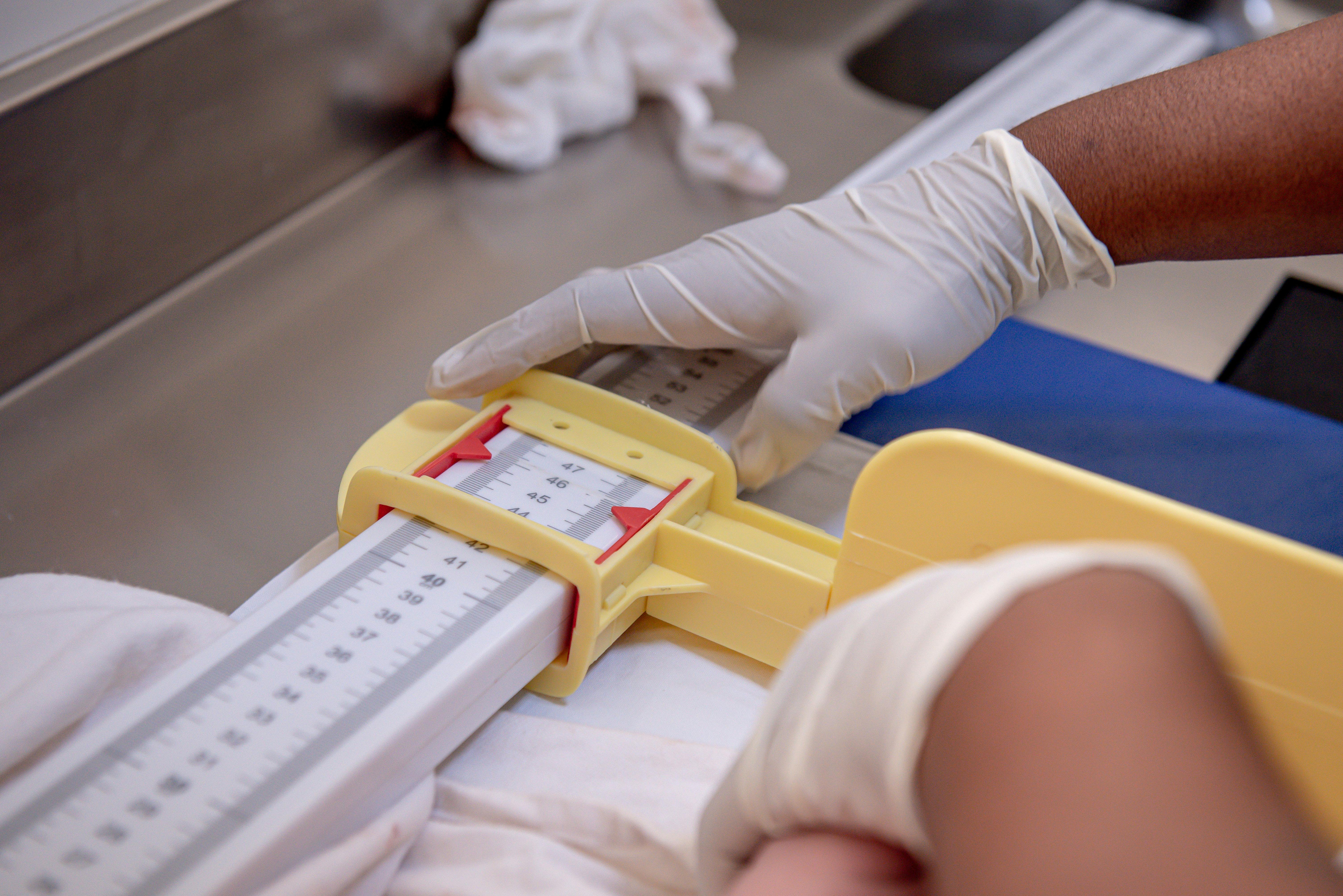 Close-up of a healthcare professional measuring an infant using a medical ruler.